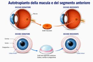 Autotrapianto della macula e del segmento anteriore ph Uff.stampa Molinette